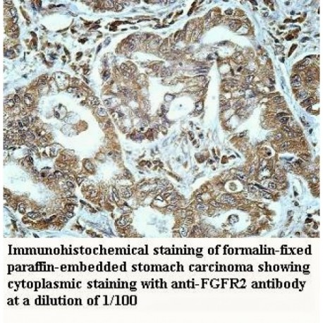 FGFR2 Antibody