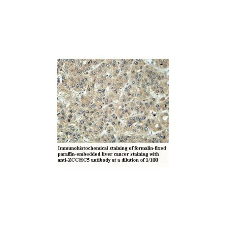 ZCCHC5 Antibody