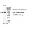 WASF2 Antibody
