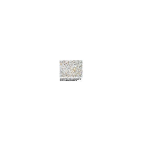 ADAMTS14 Antibody