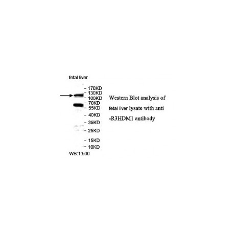 ADAMTS14 Antibody