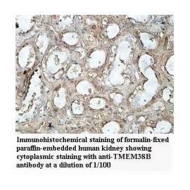 ADAMTS14 Antibody