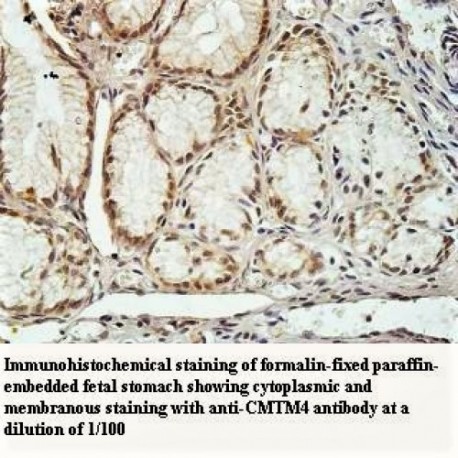 CMTM4 Antibody