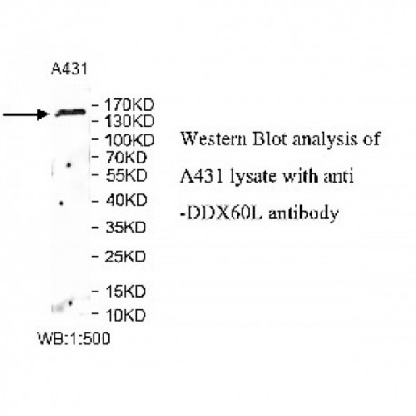 DDX60L Antibody