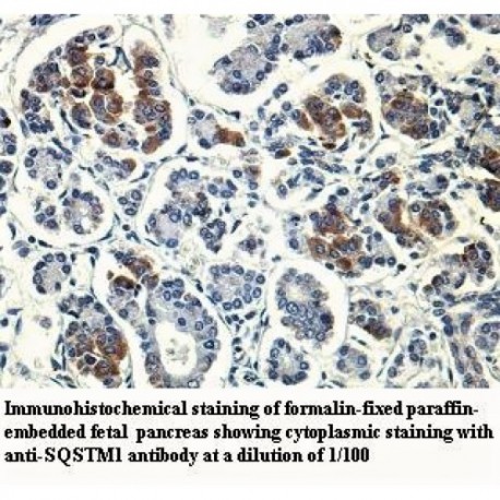 SQSTM1 Antibody