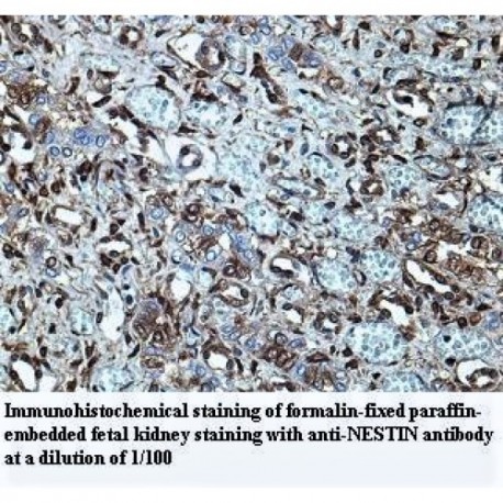 NESTIN Antibody