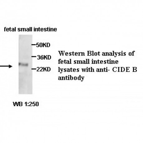 CIDEB Antibody