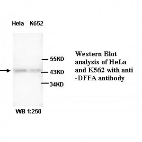 DFFA Antibody