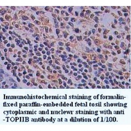 TOP2B Antibody