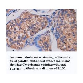 ADAMTS14 Antibody