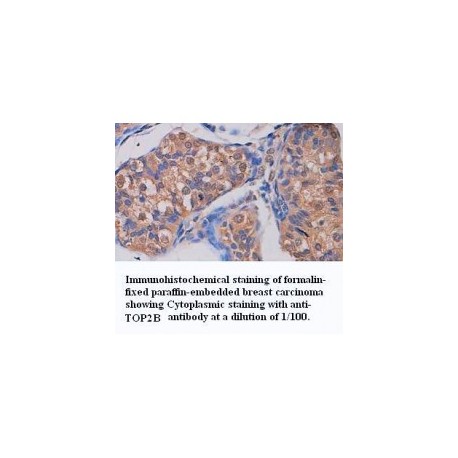 ADAMTS14 Antibody