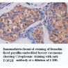 TOP2B Antibody