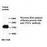 TNF Antibody