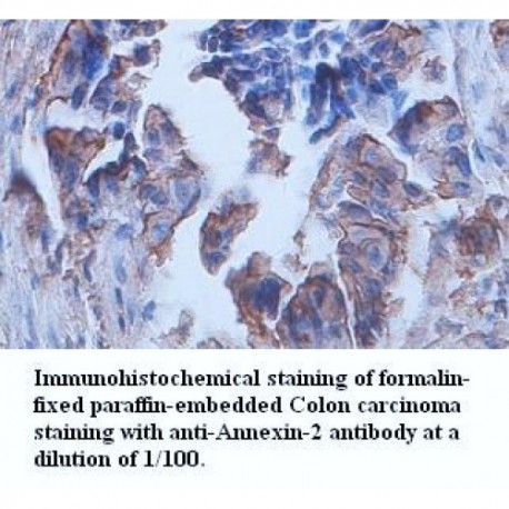 Annexin-2 Antibody