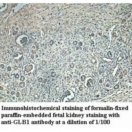 GLB1 Antibody