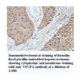 ADAMTS14 Antibody
