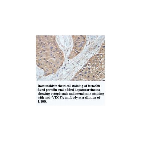 ADAMTS14 Antibody