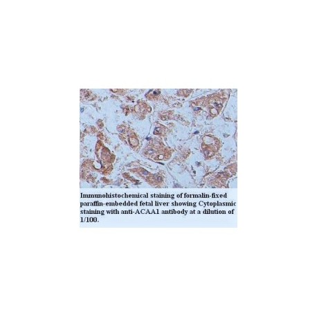 ACAA1 Antibody