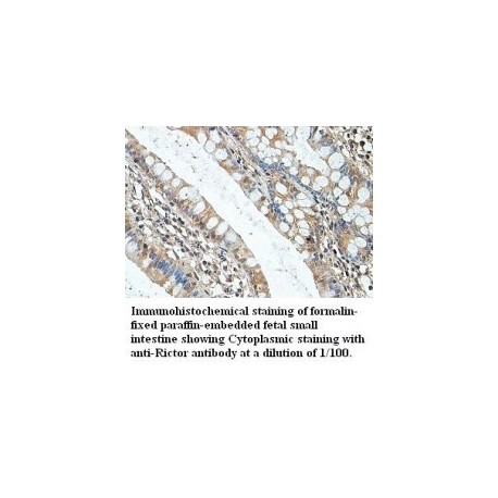 Rictor Antibody