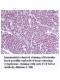 TGF Beta1 Antibody