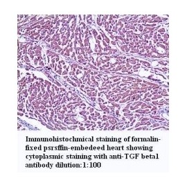 TGF Beta1 Antibody