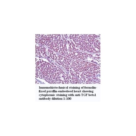 TGF Beta1 Antibody