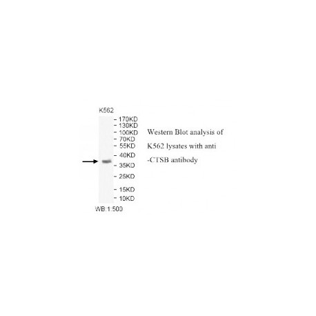 CTSB Antibody