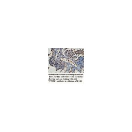TP53BP1 Antibody