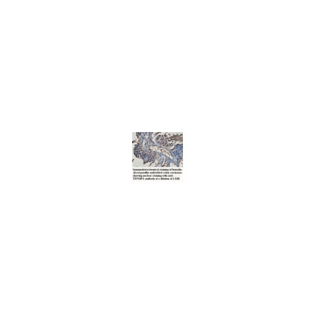 TP53BP1 Antibody