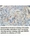 AACS Antibody