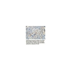 AACS Antibody