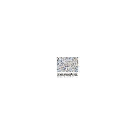 AACS Antibody