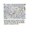 ZBED1 Antibody