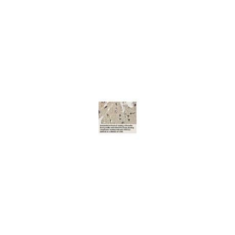 AACS Antibody