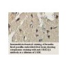 UBE2Q1 Antibody