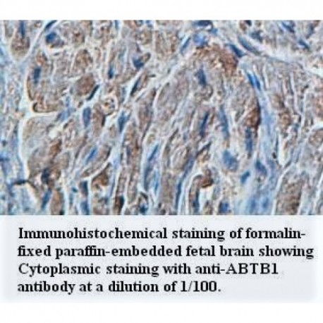 ABTB1 Antibody