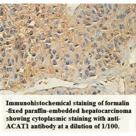 ACAT1 Antibody