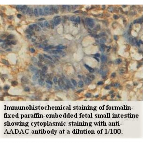 AADAC Antibody