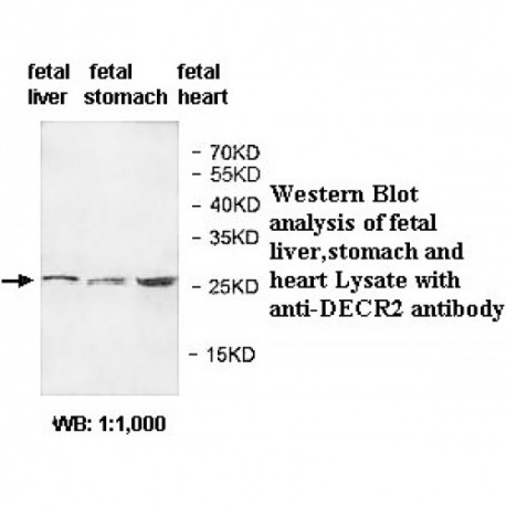 DECR2 Antibody