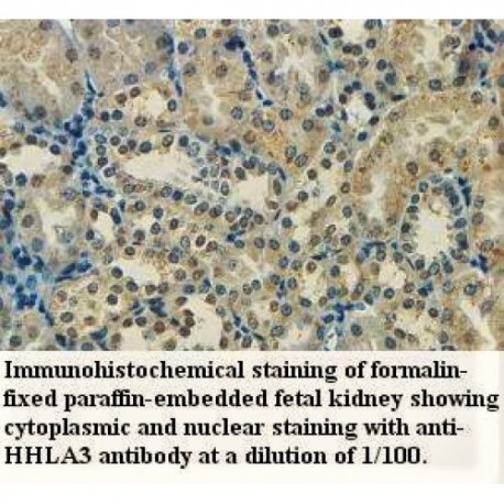 HHLA3 Antibody