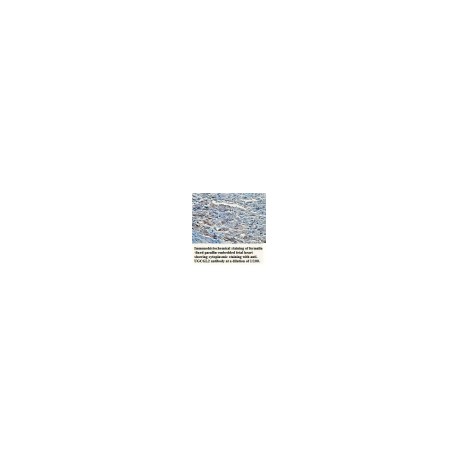 UGCGL2 Antibody