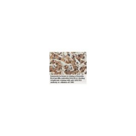 ACBD7 Antibody