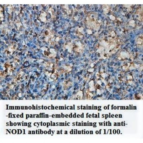 NOD1 Antibody