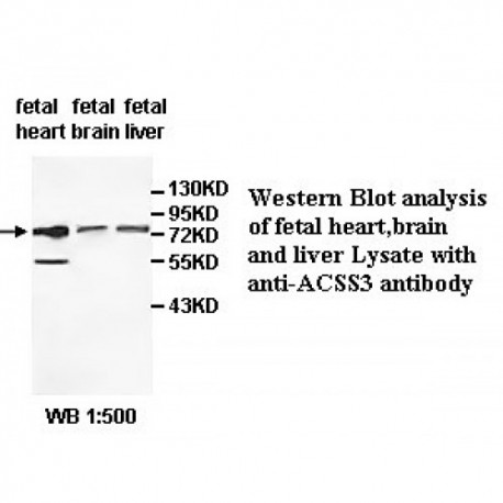 ACSS3 Antibody