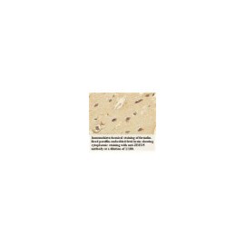 ACBD7 Antibody