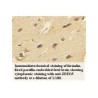 ZBED5 Antibody