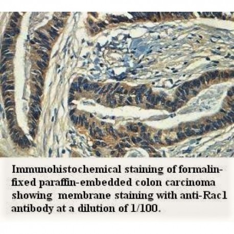 Rac1 Antibody