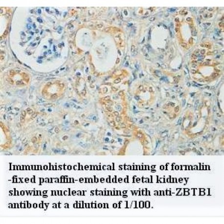 ZBTB1 Antibody