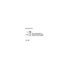 BACE1 Antibody