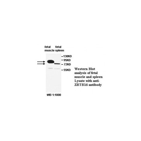 ZBTB6 Antibody